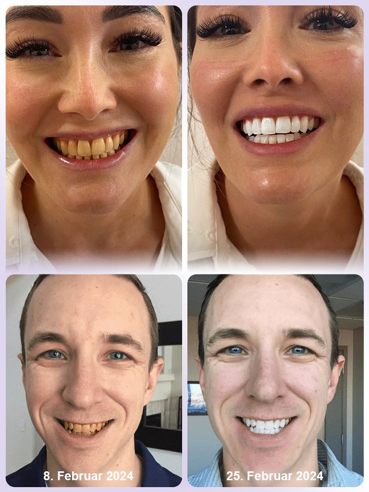 【Parodontale Gesundheit wiederherstellen】Zahnerneuerung lila Mineralzahnpulver