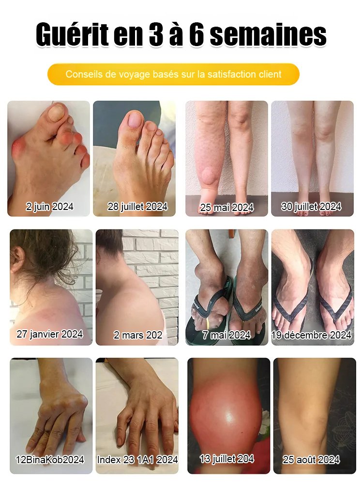 Crème analgésique et cicatrisante au venin d'abeille