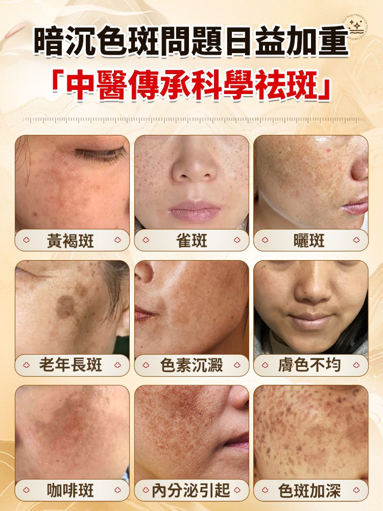 【專攻頑固斑點】美白強效祛斑霜濃縮版