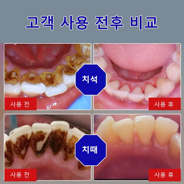 [입냄새 제거 및 잇몸 케어] 베이킹소다 효소 화이트닝 치약