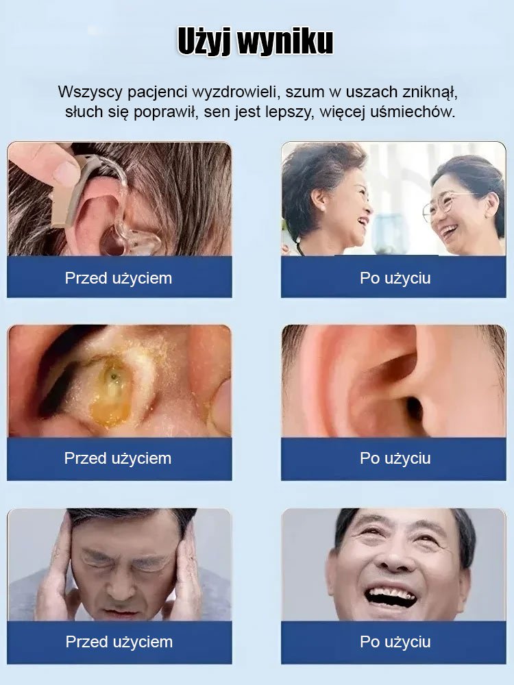 【Skoncentruj się na zdrowiu uszu】 Yunnan Materia Medica Cerumen Ear Wash