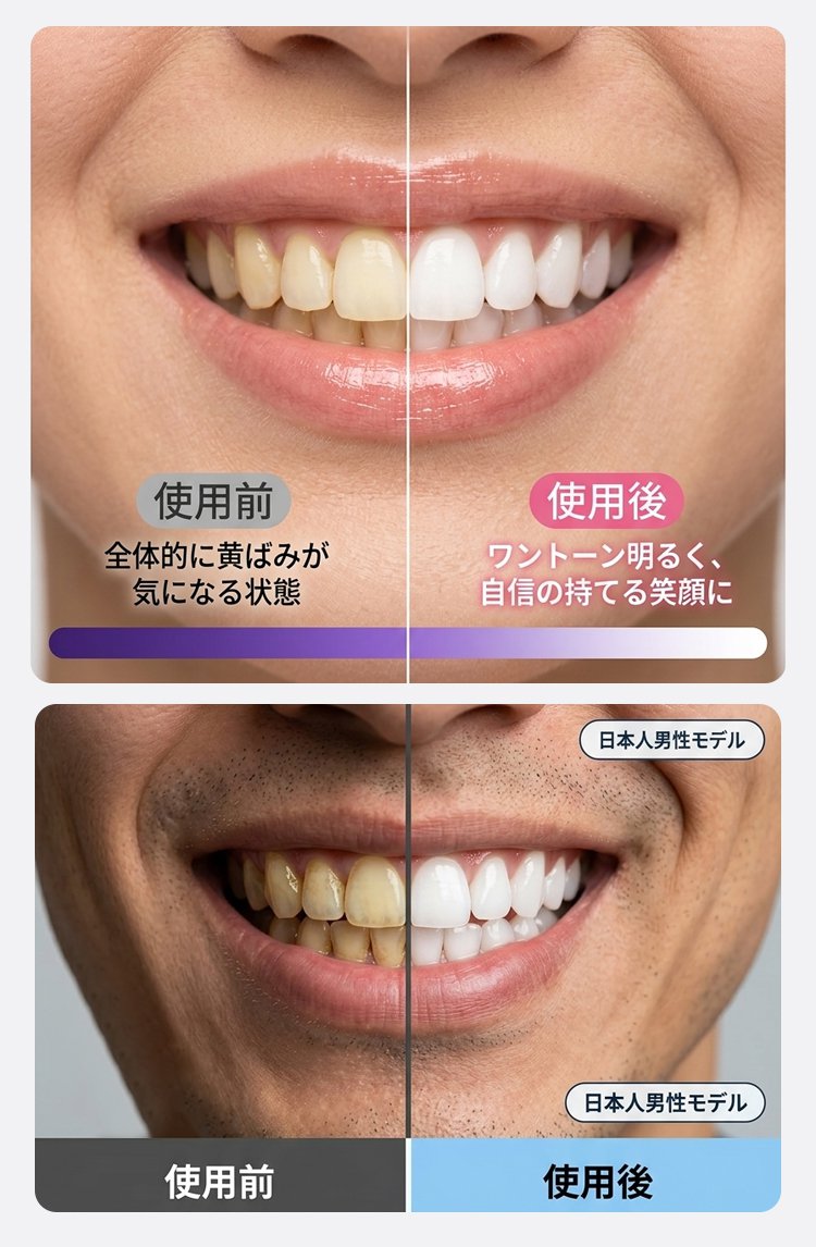 牙齿美白_18.jpg