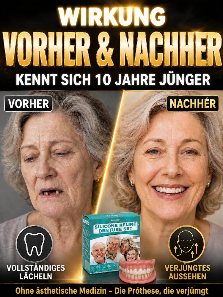 DIYcos Komplettes Zahnabdruck-Set Oben und Unten