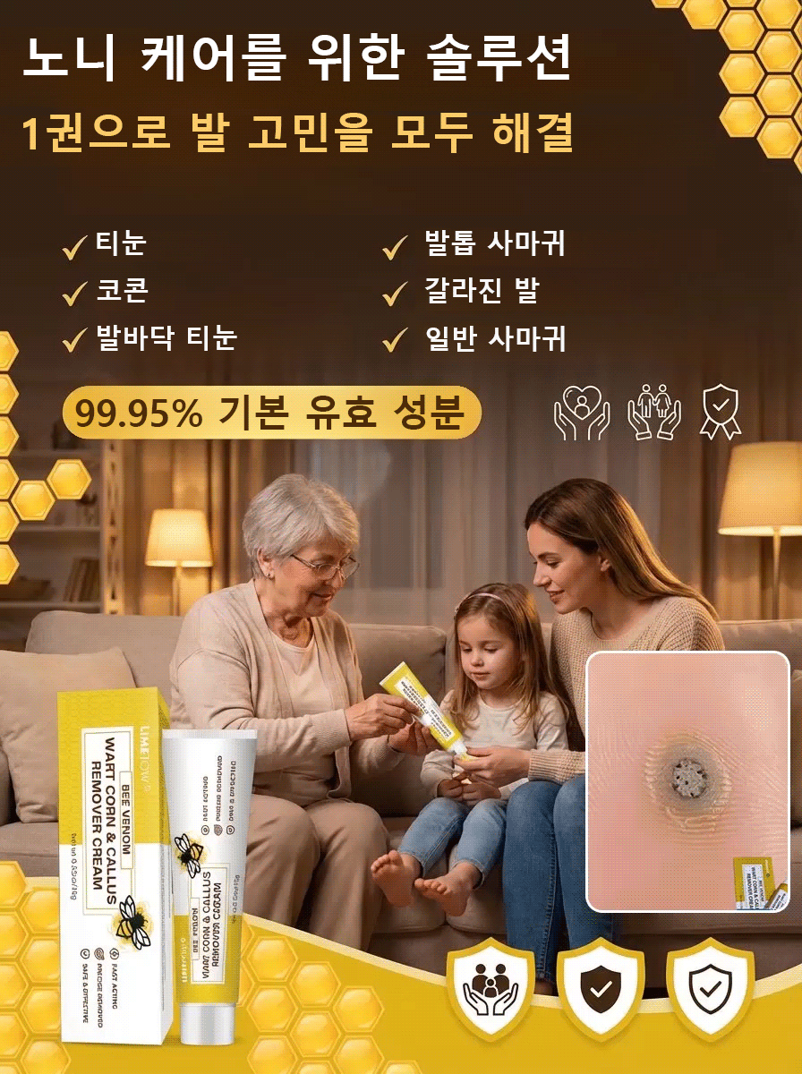 티눈 및 굳은살 제거 봉독 크림