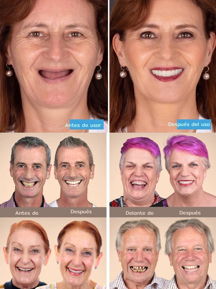 Set cosmético para prótesis dentales【Compra 1 y llévate 1 gratis】