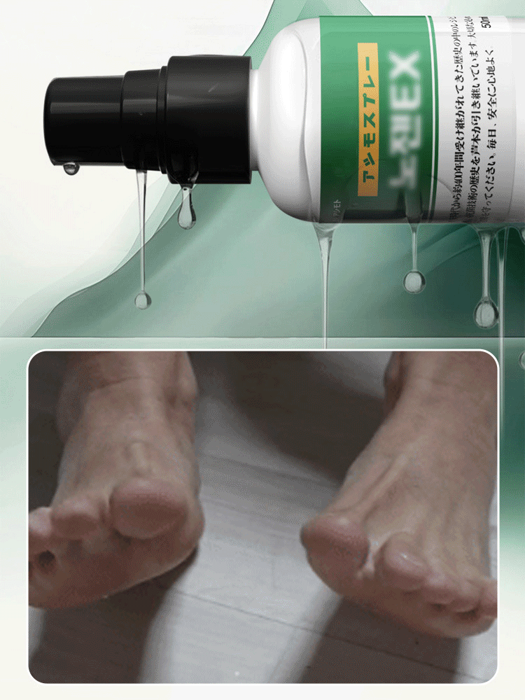 【3일 간지러움 완화】항균 발냄새 케어 스프레이