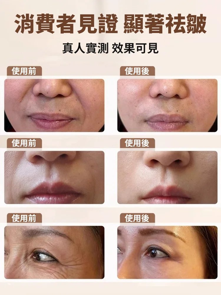 【皺紋一抹消】多肽針管填充膠原霜