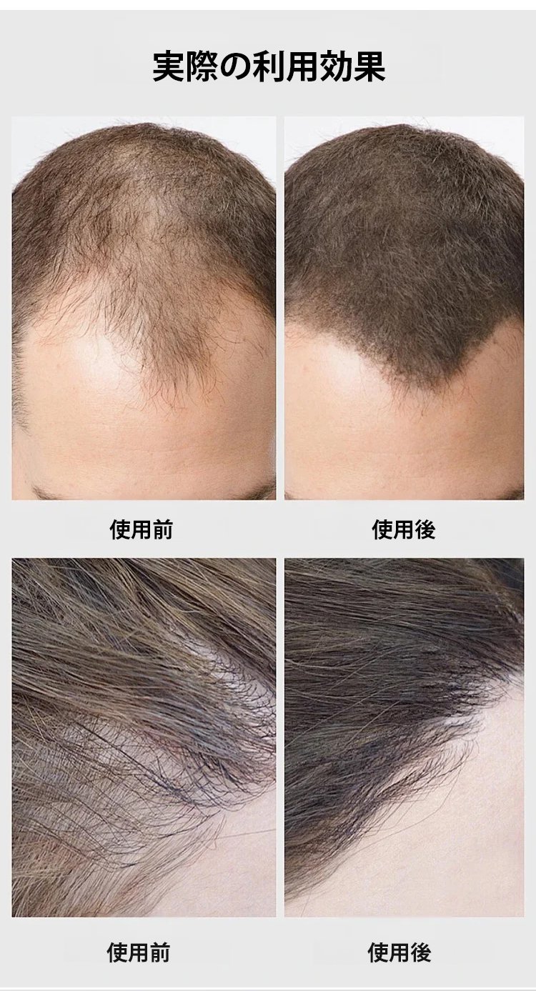 翻译件-HFH-【即时效果，持久10天】防水头发遮瑕膏-1291935-系统-(1)_13.jpg