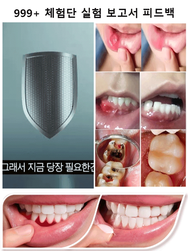 【살균율 99%】구강 유산균 스프레이