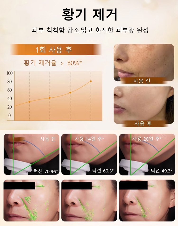 【한 병으로 동안 완성】주름 개선 앰플