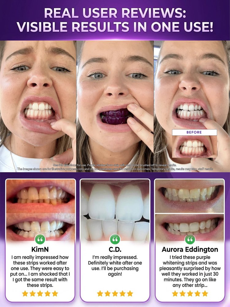 [Visible Results After One Use] No More Repeated Whitening Strips