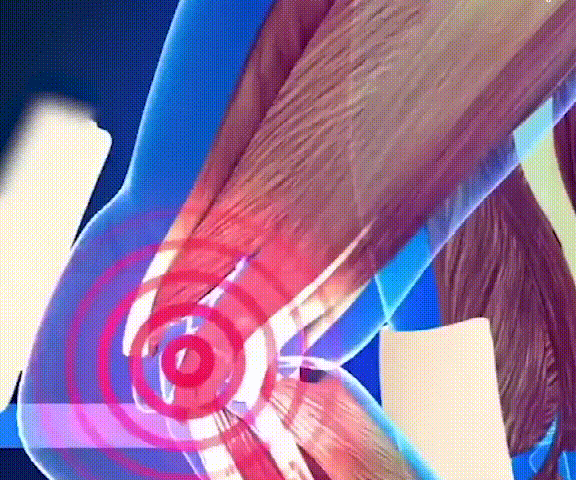 9882c58a47b61fa6ccd7bbd80243cda4.gif