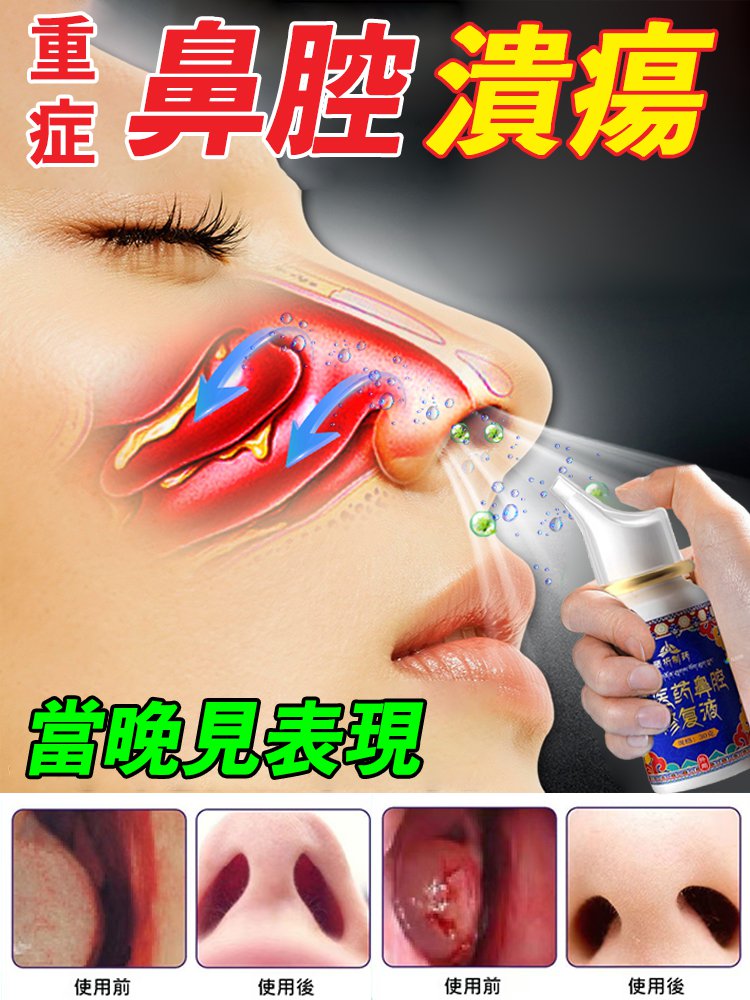 【一噴通鼻】西藏非遺鼻腔修復液