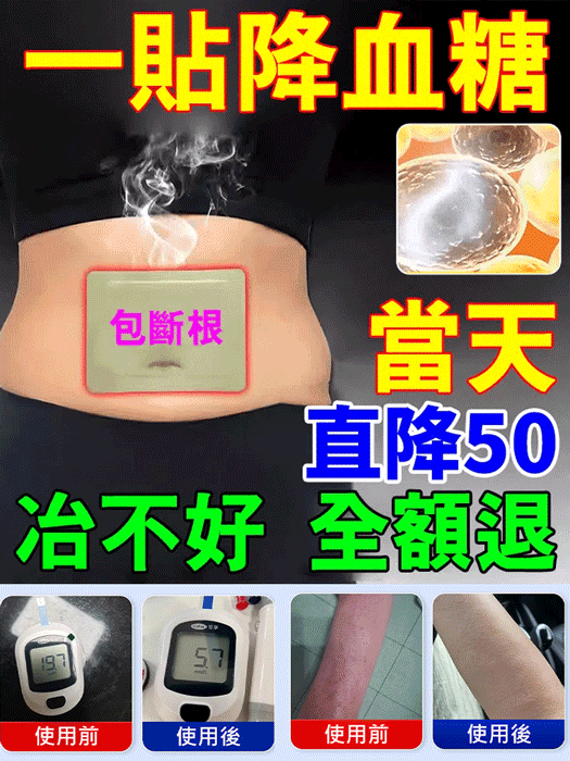 溫灸穴位控製糖貼