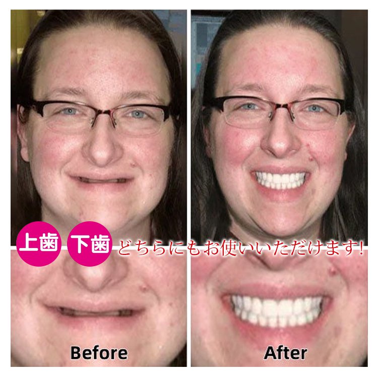 入れ歯用美容ケアセット