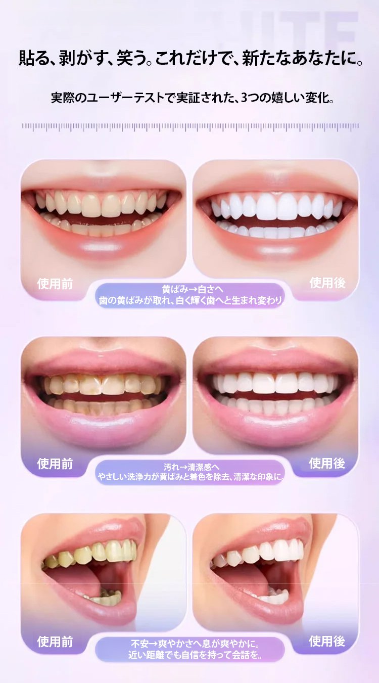 翻译件-FM-一贴白展现自信笑容爆款美白去黄牙贴-1341273_21.jpg