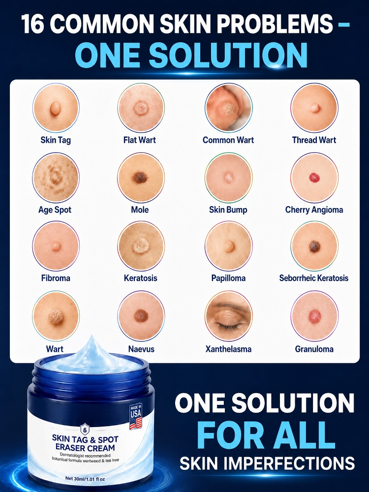 7 Days Fast Skin Growth Remover Cream