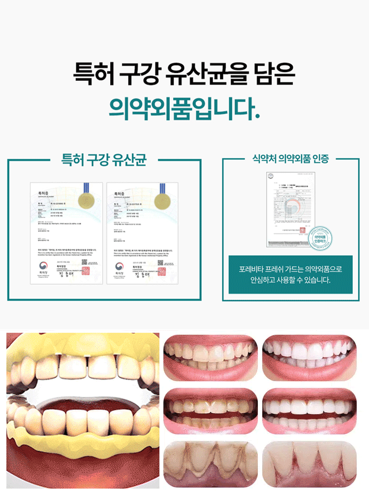 【살균율 99%】구강 유산균 스프레이