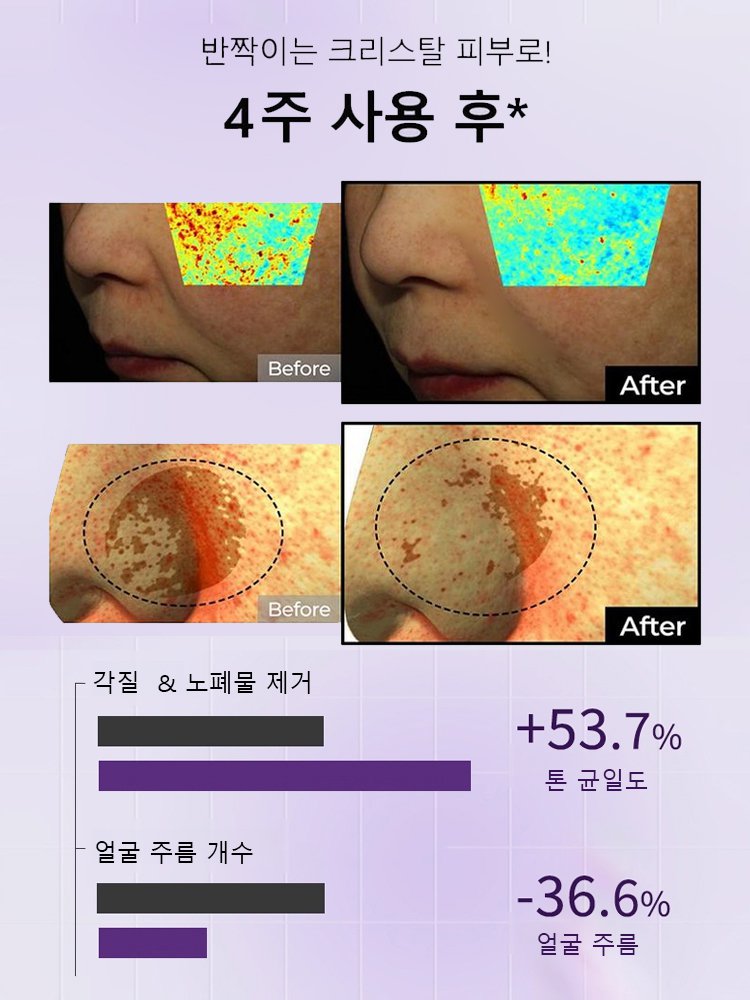 화이트닝 주름개선 에센스【 7일 동안 잡티 완화 미백】