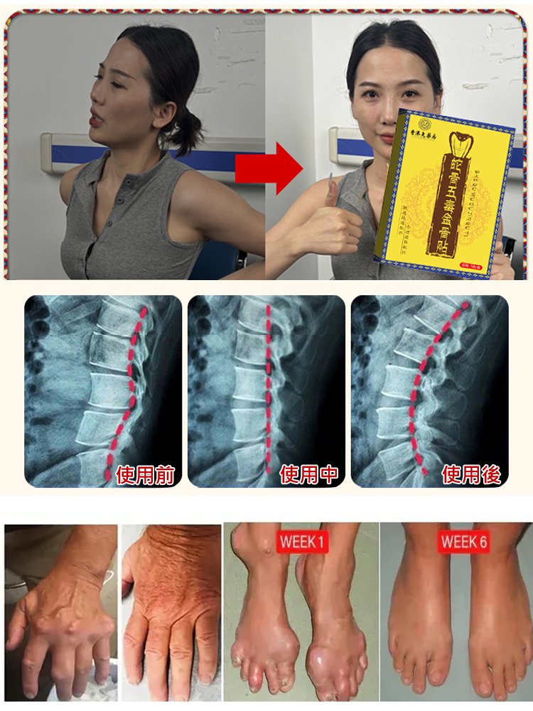 蛇骨五毒金骨貼