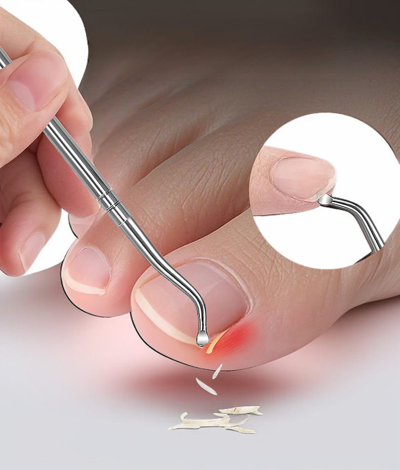 여행용으로 적합한 손톱깎이 휴대 이미지