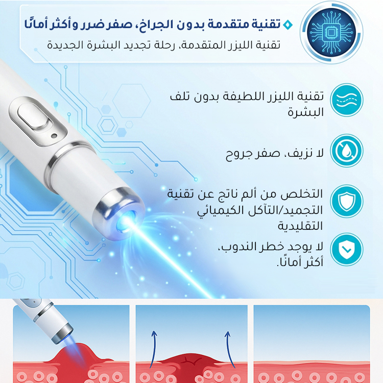 قلم العناية بالبشرة لإزالة الثأليل