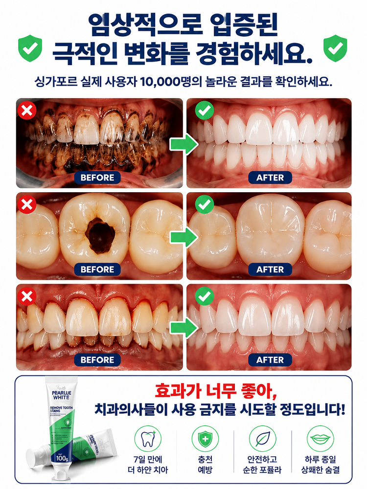 【1초 만에 10년 치 황니 제거】썩은 이를 되살리는 프로바이오틱스 치약