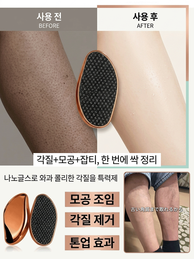전신용 무통 제모기