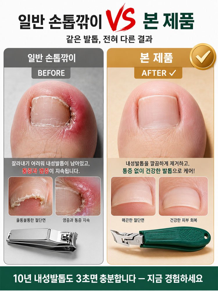 【장마철 대비】내성 발톱 전용 네일 클리퍼