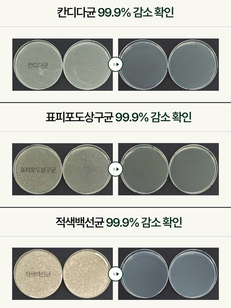 【3일 간지러움 완화】항균 발냄새 케어 스프레이