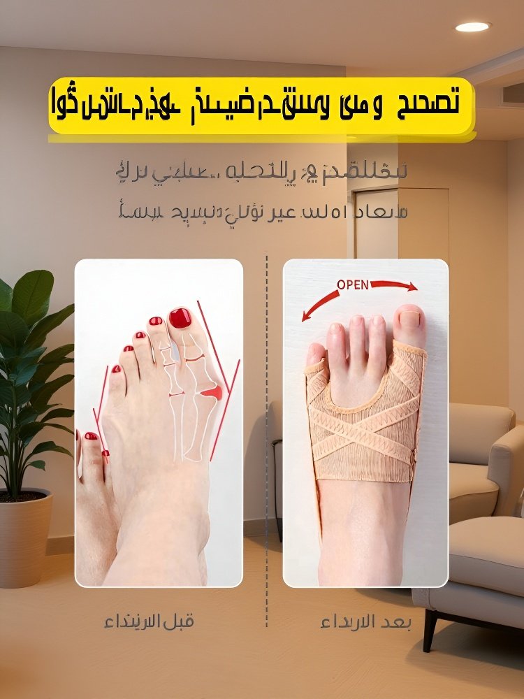 مصحح إبهام القدم الألماني بدون تدخل جراحي