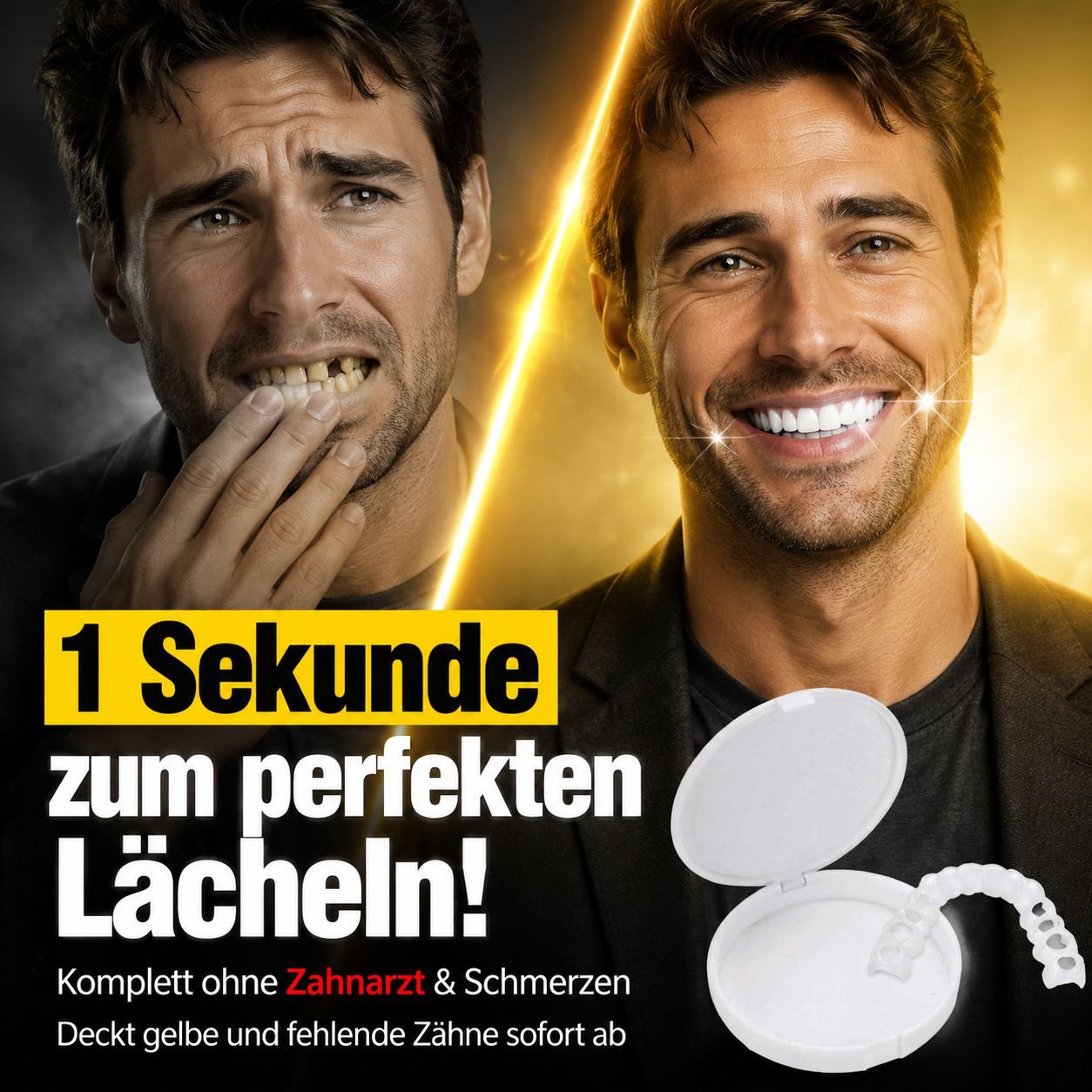 Simulation Zahnkorrektur Aufhellungs-Veneers