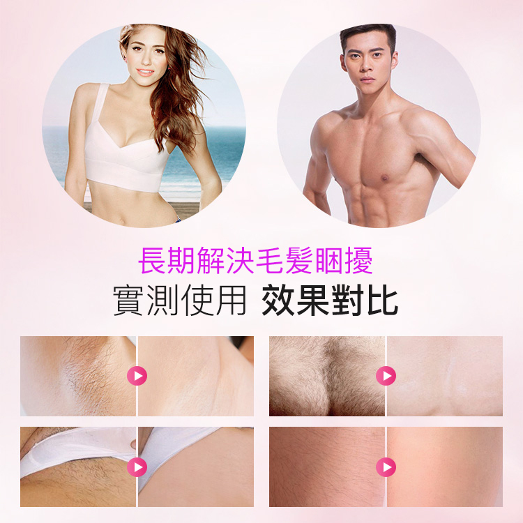 美國激光脫毛儀