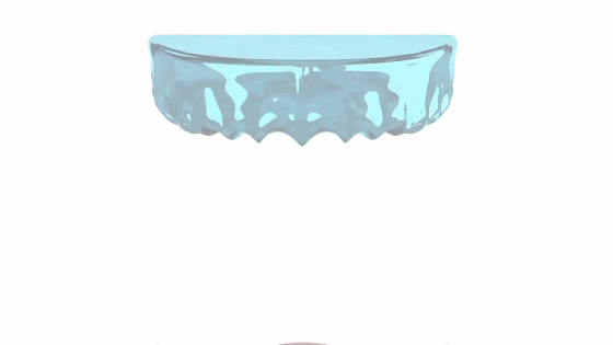 【美國原裝進口】Snapon Smile 第四代升級款美白牙齒套