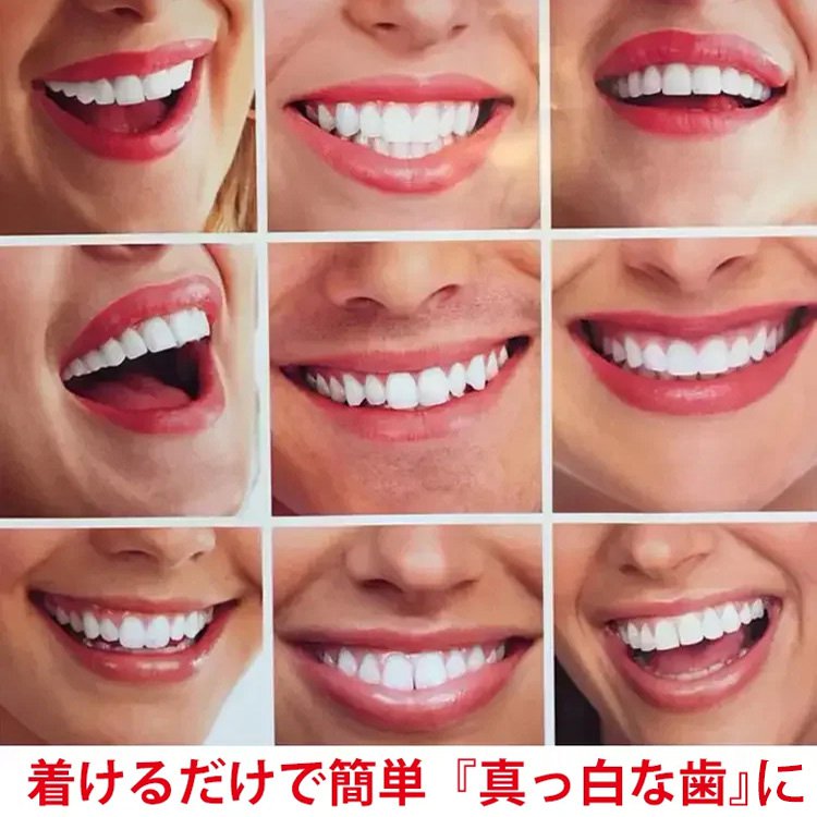 『インスタントスマイル』instant smile四代目  着脱可能な美白付け歯  素敵な笑顏を取り戻します！