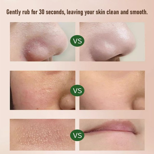 Exfoliating Dead Skin Removal Gel