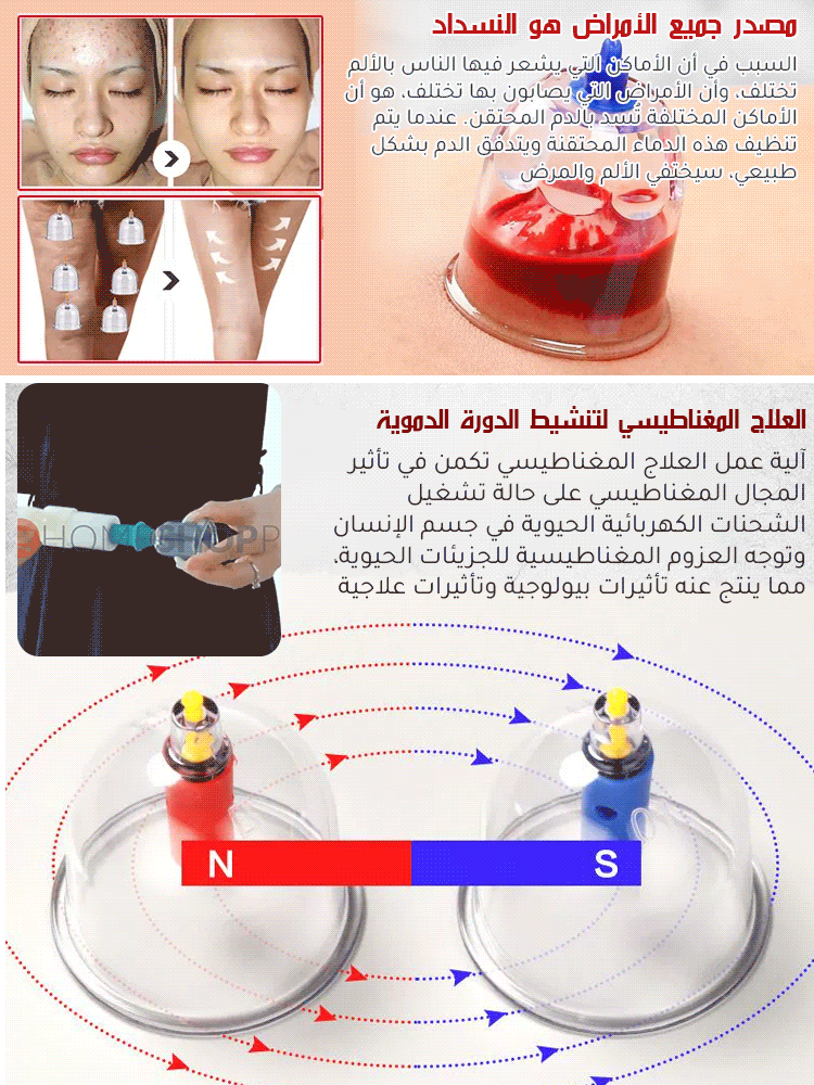 جهاز الحجامة بالفراغ المنزلي (مانع للحروق)