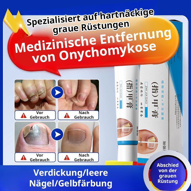 [Schmerzlos und kein Wiederauftreten] Onychomykosesalbe