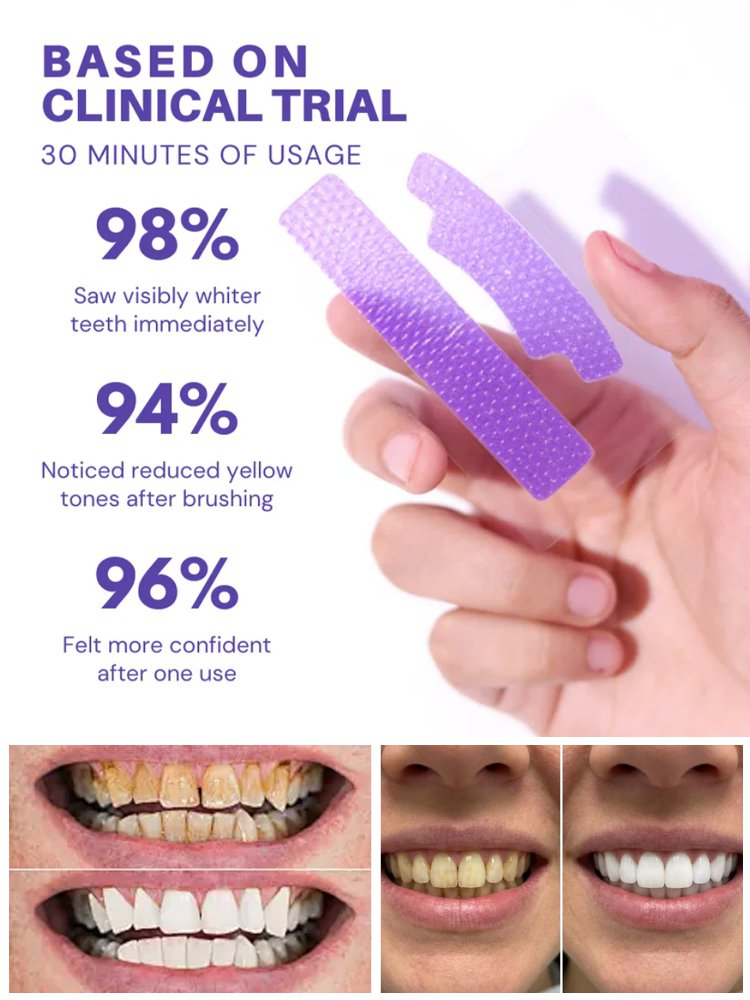 【At-Home Dental Whitening】Instant Whitening Strips