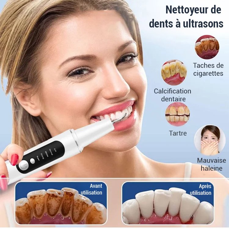 Appareil de nettoyage dentaire à ultrasons pour blanchiment des dents