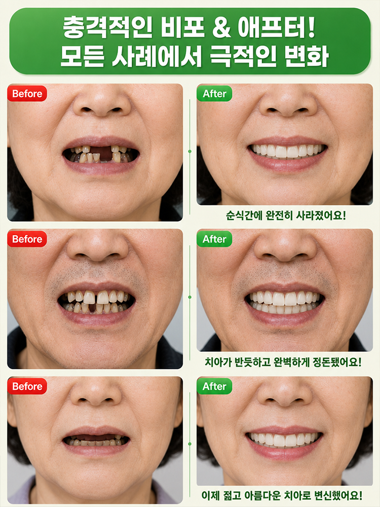 편안하고 아름다운 틀니