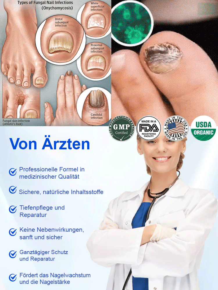 [Zurück zu Ihren gesunden Nägeln] Nail Repair Care Essence