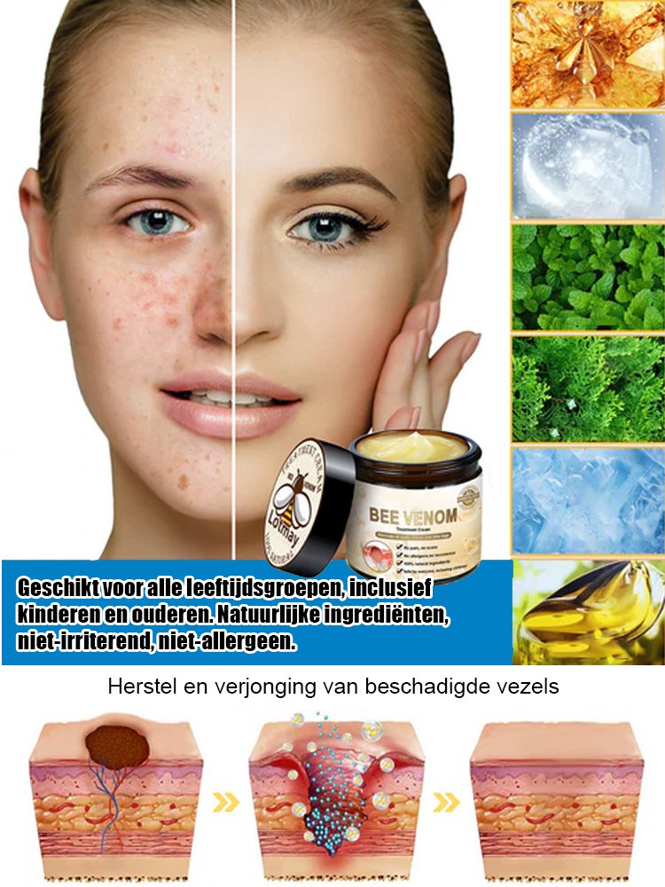 Huidherstellende Crème voor Vlekken en Littekens