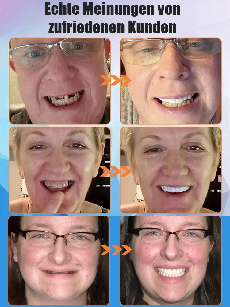 [Neue britische Forschungsergebnisse] Silikon-Simulationszahnspangen