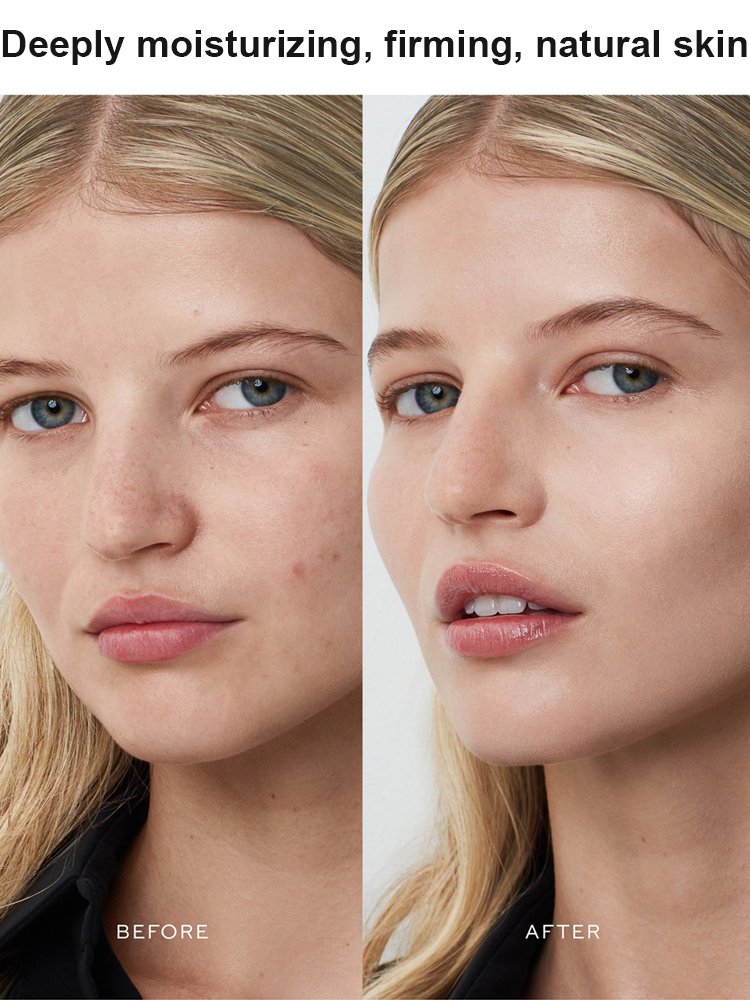 peterthomasr Eye Tightener