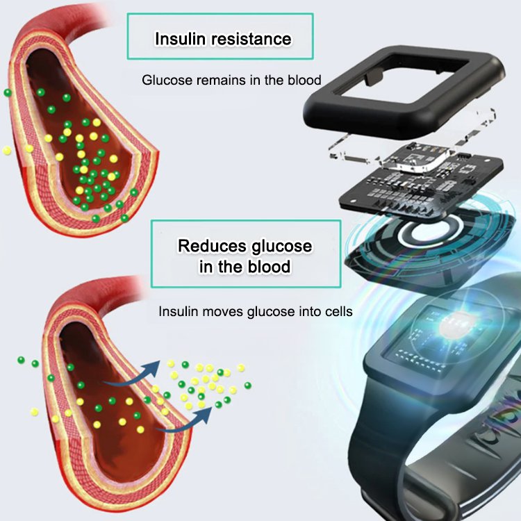 Ultrasonic blood sugar balance bracelet