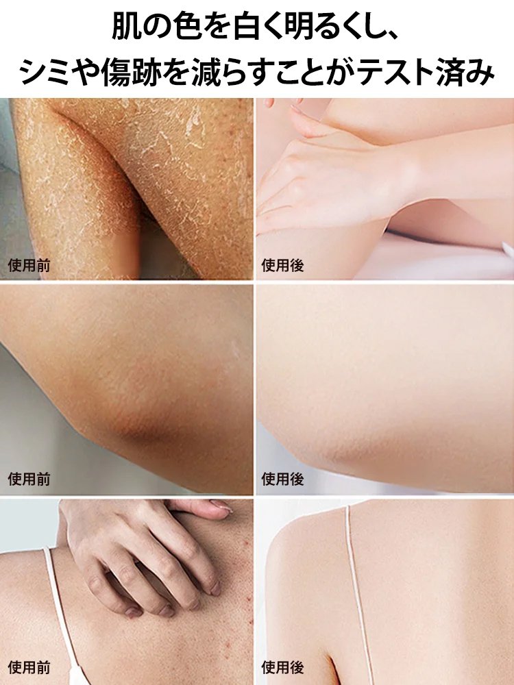 【ニキビと吹き出物のケア】サリチル酸配合美白ボディウォッシュ