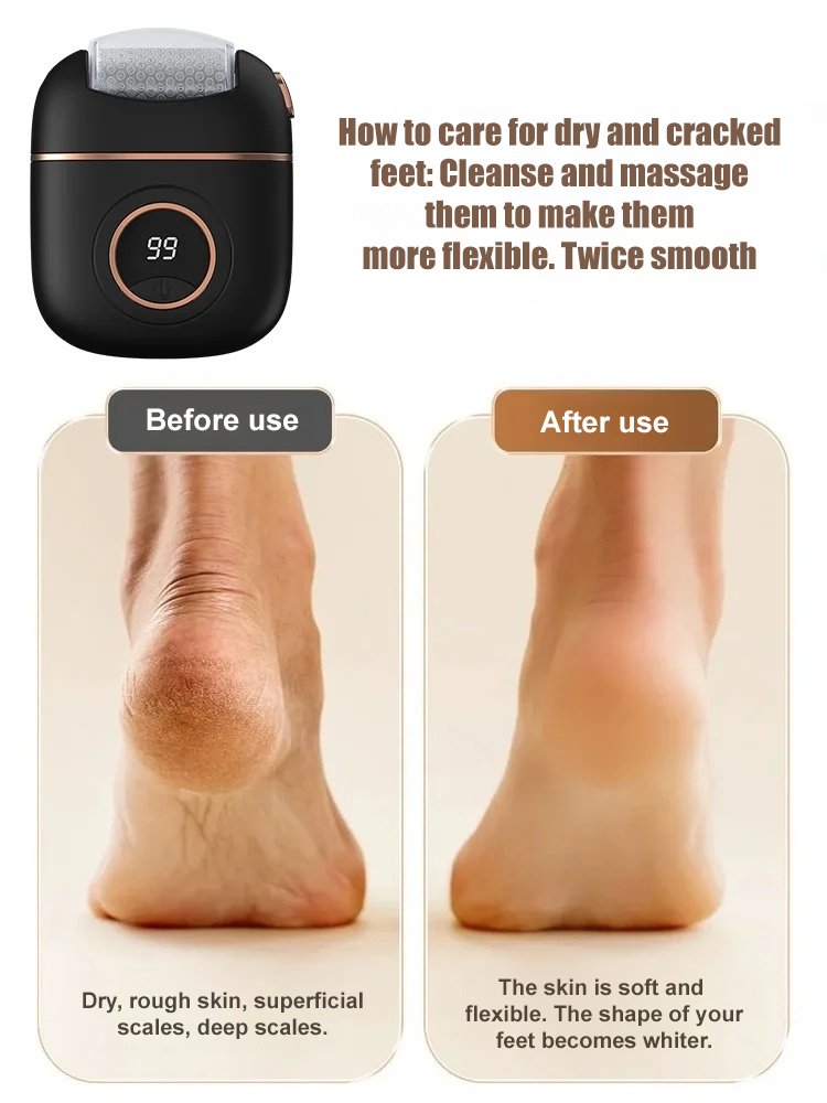 New Digital Digital Electric Foot Polisher