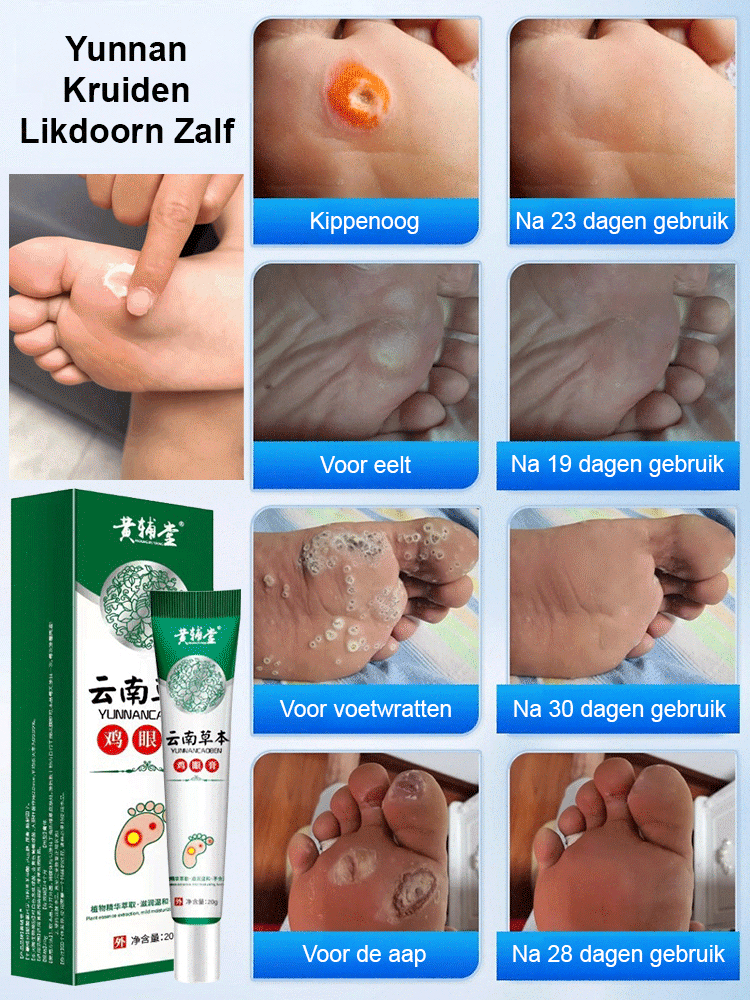 7 Dagen Kruidige Rups Verwijderingscreme