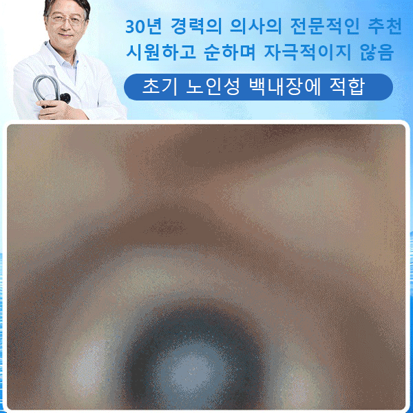 시력 교정 안약